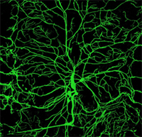 dendrite image